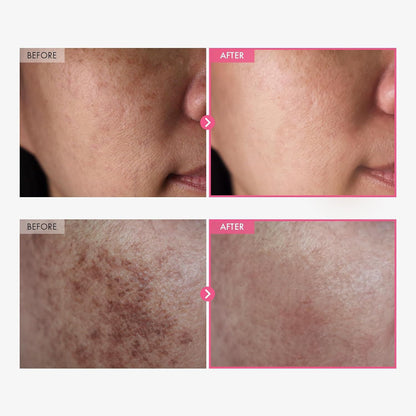 Skin Care Cream PromoPro Africa 